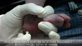 Forma Correcta de Recolectar la Muestra para el Tamiz Neonatal [upl. by Nylednarb19]