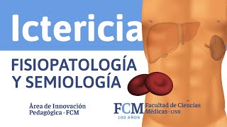 Ictericia  Fisiopatología y Semiología [upl. by Ammamaria]