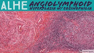 Eosinophils  Causes of High and Low Eosinophils [upl. by Ahsineb]