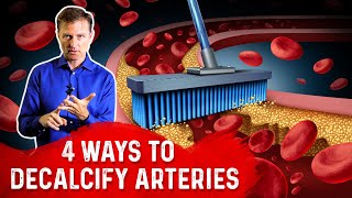 4 Ways To Decalcify Your Arteries – Dr Berg [upl. by Onilegna977]