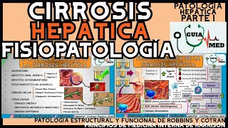 CIRROSIS HEPÁTICA FISIOPATOLOGÍA  GuiaMed [upl. by Blase918]