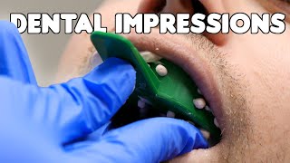 Dental Impressions amp Pouring Teeth Models [upl. by Llerrut]