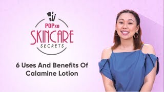 6 Uses And Benefits Of Calamine Lotion  POPxo Skincare Secrets [upl. by Fonzie52]