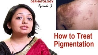 How to Treat Skin Pigmentation Episode 3 [upl. by Jenni112]