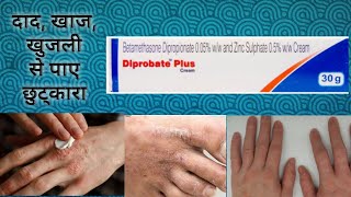 Diprobate Plus Cream  Diprobate Plus Cream Review In Hindi खाज खुजली और फंगल इन्फेक्शन से देगा [upl. by Septima]