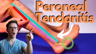 Peroneal Tendonitis Treatment 2024 Peroneus Brevis amp Longus Pain [upl. by Gleason]