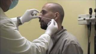 How to Collect a Nasopharyngeal NP Swab Specimen [upl. by Cates182]