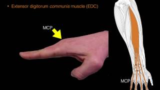 Forearm extensor muscles [upl. by Onilatac]