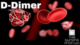 What the D Dimer test tells you [upl. by Dom]