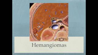 Caracterización de Lesión Focal Hepática [upl. by Nawj]