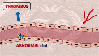 D dimer test  made easy with diagram [upl. by Arreyt]