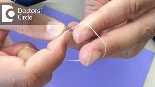 What is Rubber Band Ligation amp how is it done  Dr Nagaraj B Puttaswamy [upl. by Adriell]