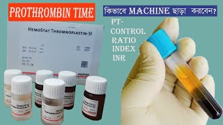 Prothrombin Time Test  PT INDEX INR [upl. by Rebor]