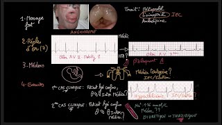 Traitement de lhypertension artérielle  Guidelines  Exercices  HTA  Docteur Synapse [upl. by Rein]