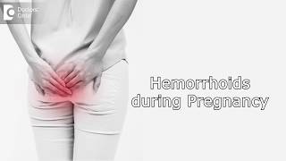 How to manage Hemorrhoids during Pregnancy  Dr Rashmi Chaudhary [upl. by Crispin]