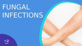 Fungal Infections  Causes Prevention and Cure [upl. by Anoblav]